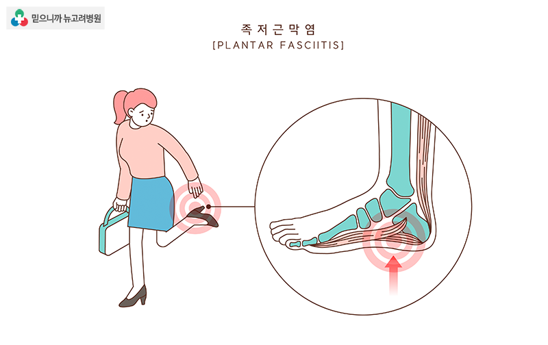 족저근막염(족부)