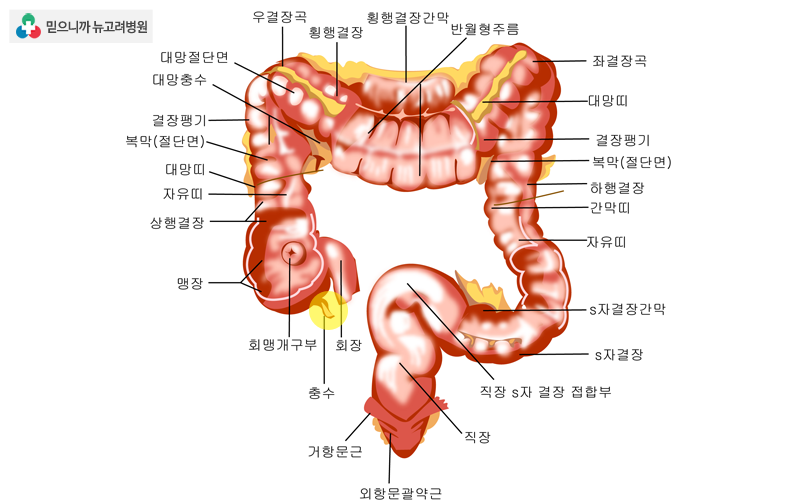 충수염